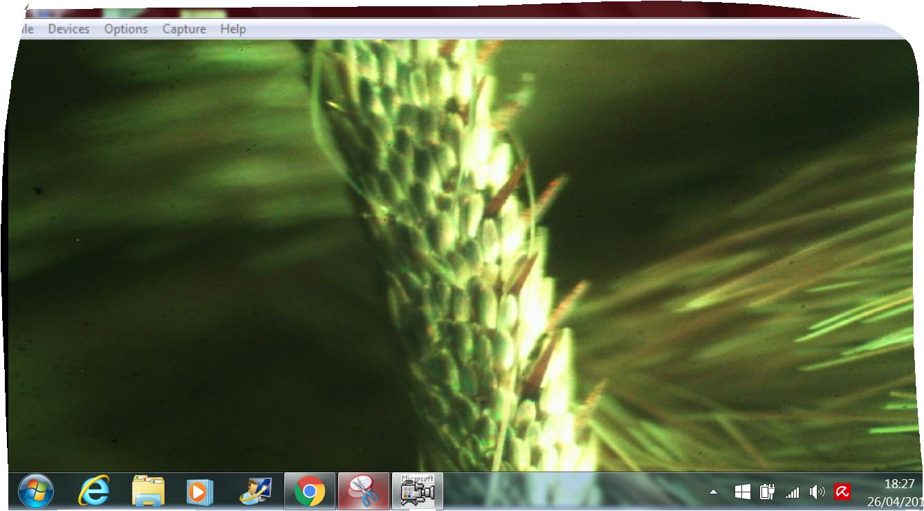 vorticella?